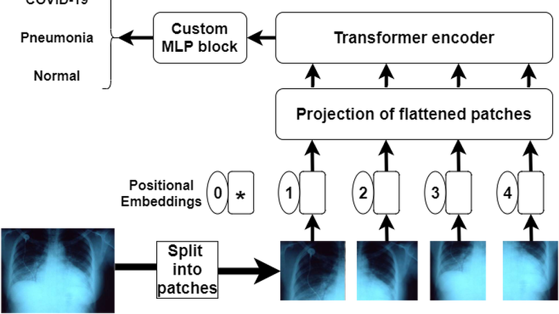 COVID-Transformer: Interpretable COVID-19 Detection using Vision Transformer for Healthcare